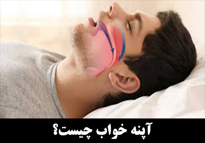 آپنه خواب چیست؟