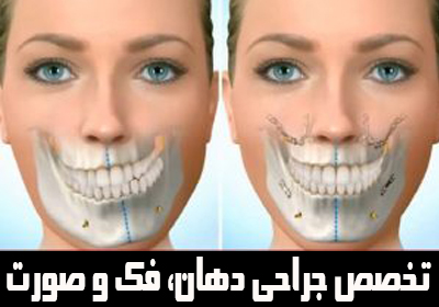 معرفی تخصص جراحی دهان فک و صورت