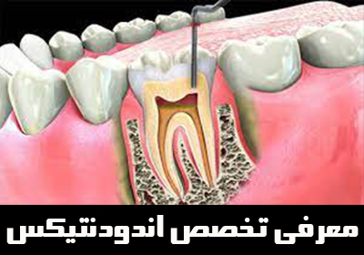 معرفی تخصص اندودنتیکس