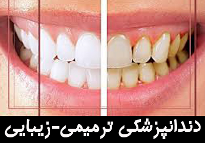 معرفی تخصص دندانپزشکی ترمیمی-زیبایی 