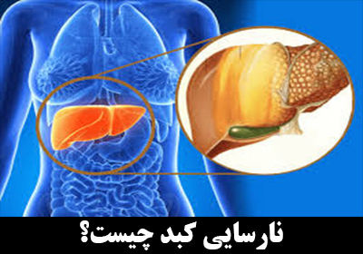 نارسایی کبدی چیست؟