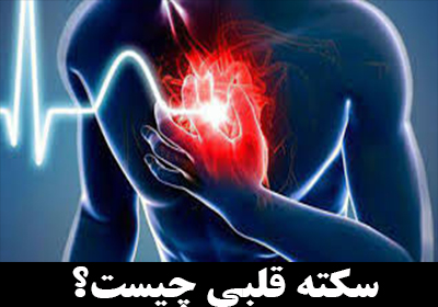 سکته قلبی چیست؟ علائم سکته قلبی