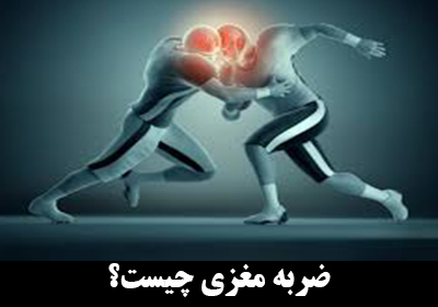 ضربه مغزی چیست؟