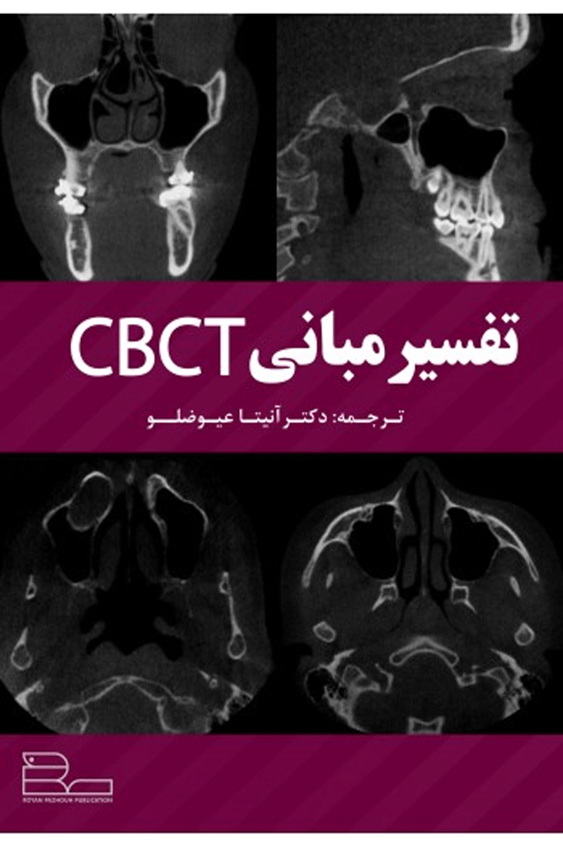 کتاب تفسیر مبانی CBCT-نویسنده دکتر آنیتاعیوضلو