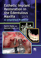 کتاب Esthetic Implant Restoration in the Edentulous Maxilla - نویسنده Karim  Dada