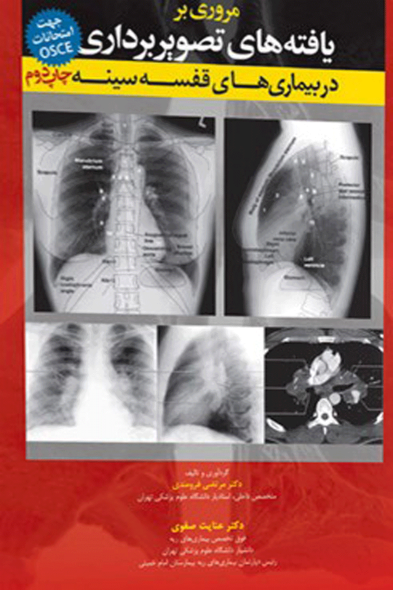 کتاب مروری بر یافته های تصویربرداری در بیماری های قفسه سینه - جهت امتحانات OSCE-نویسنده دکتر مرتضی فرومندی - دکتر عنایت صفوی