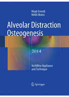 کتاب Alveolar Distraction Osteogenesis 2014_تألیف Nejat Erverdi - Melih Motro