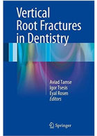 کتاب Vertical Root Fractures in Dentistry -  نویسنده  Igor Tsesis 