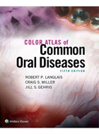 کتاب Color Atlas of Common Oral Diseases 2017- نویسنده Craig Miller