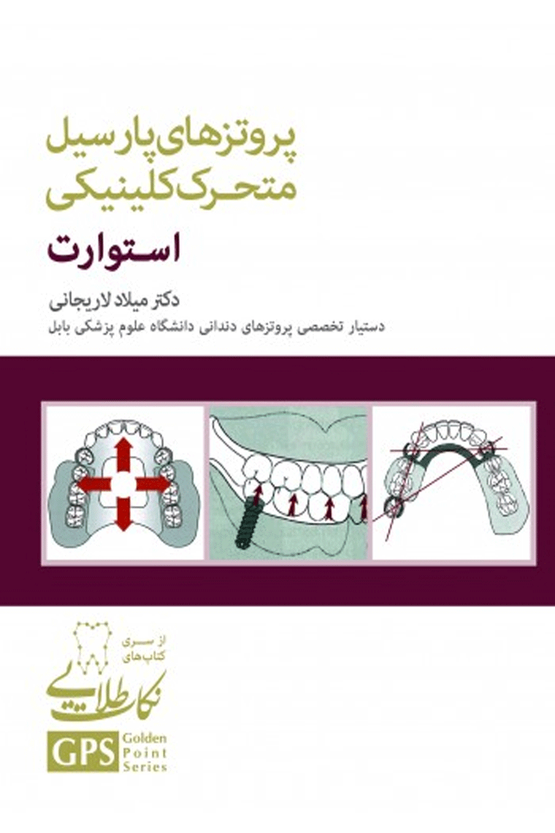 کتاب پروتزهای پارسیل متحرک کلینیکی استوارت- از سری کتاب های نکات طلایی GPS-نویسنده دکتر میلاد لاریجانی