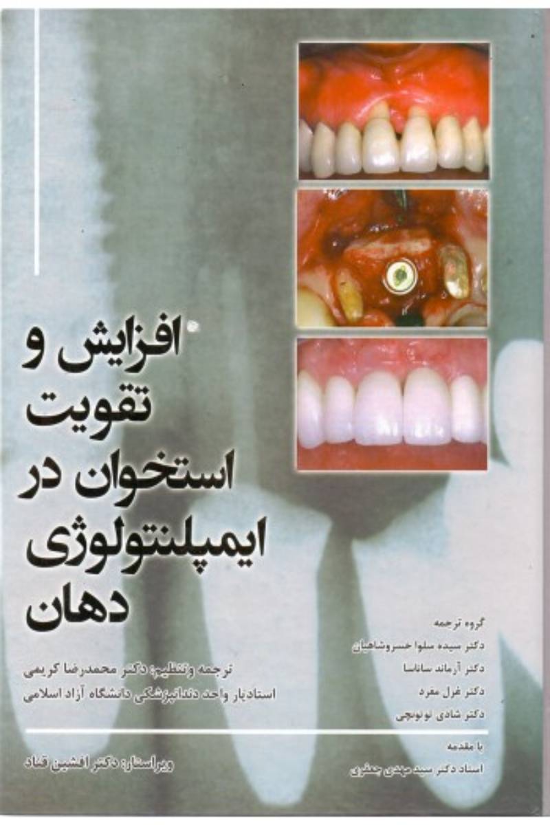 کتاب افزایش و تقویت استخوان در ایمپلنتولوژی دهان-نویسنده دکتر محمدرضا کریمی