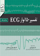 کتاب تفسیر 150 نوار ECG دکتر منوچهر قارونی - نویسنده جان هامپتون - مترجم دکتر نیلوفر جوهری ورنوسفادرانی