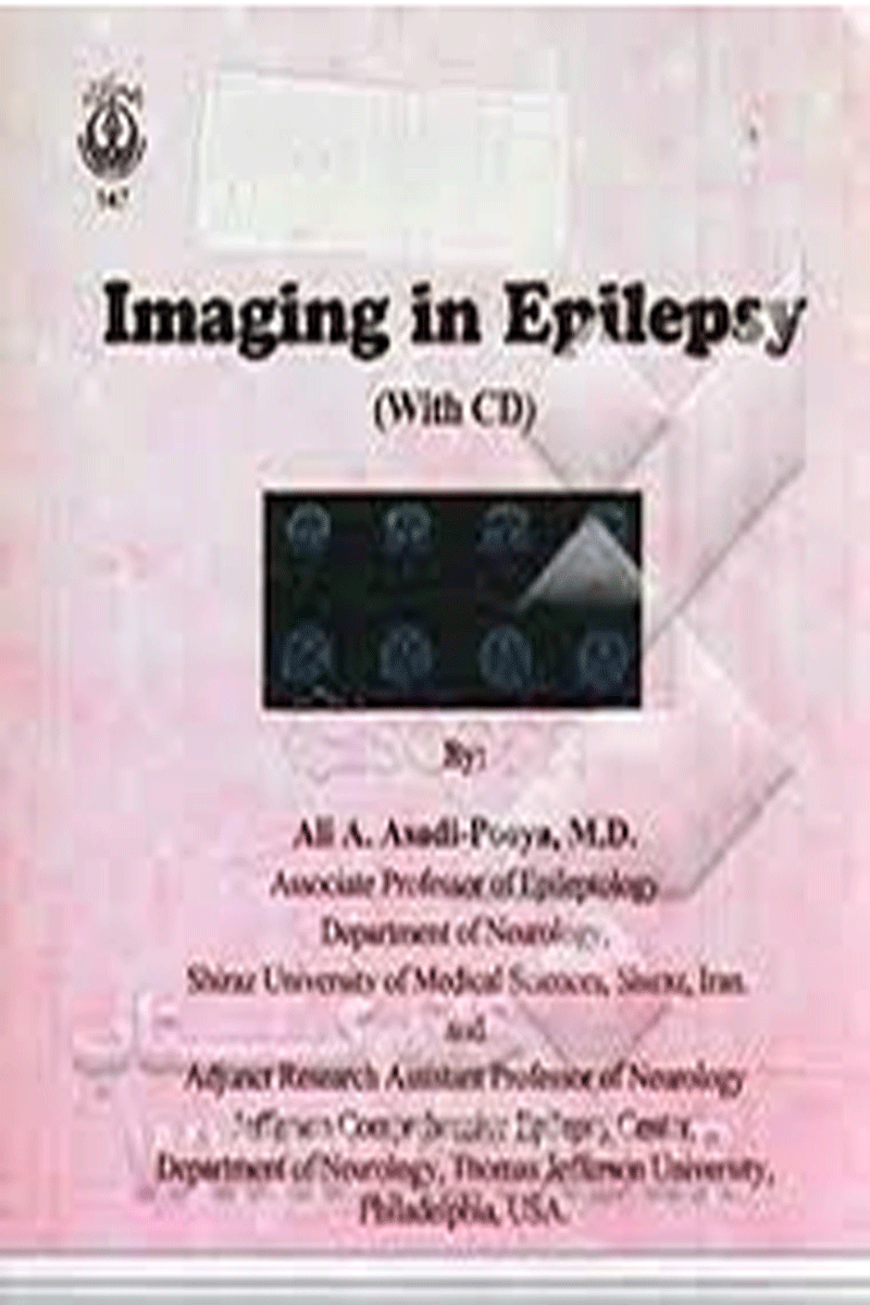 کتاب Imaging in Epilepsy - With CD-نویسنده Ali A Asadi-Pooya و دیگران