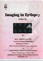 کتاب Imaging in Epilepsy - With CD-نویسنده Ali A Asadi-Pooya و دیگران