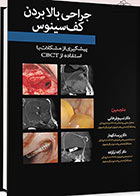 کتاب جراحی بالا بردن کف سینوس پیشگیری از مشکلات با استفاده از CBCT