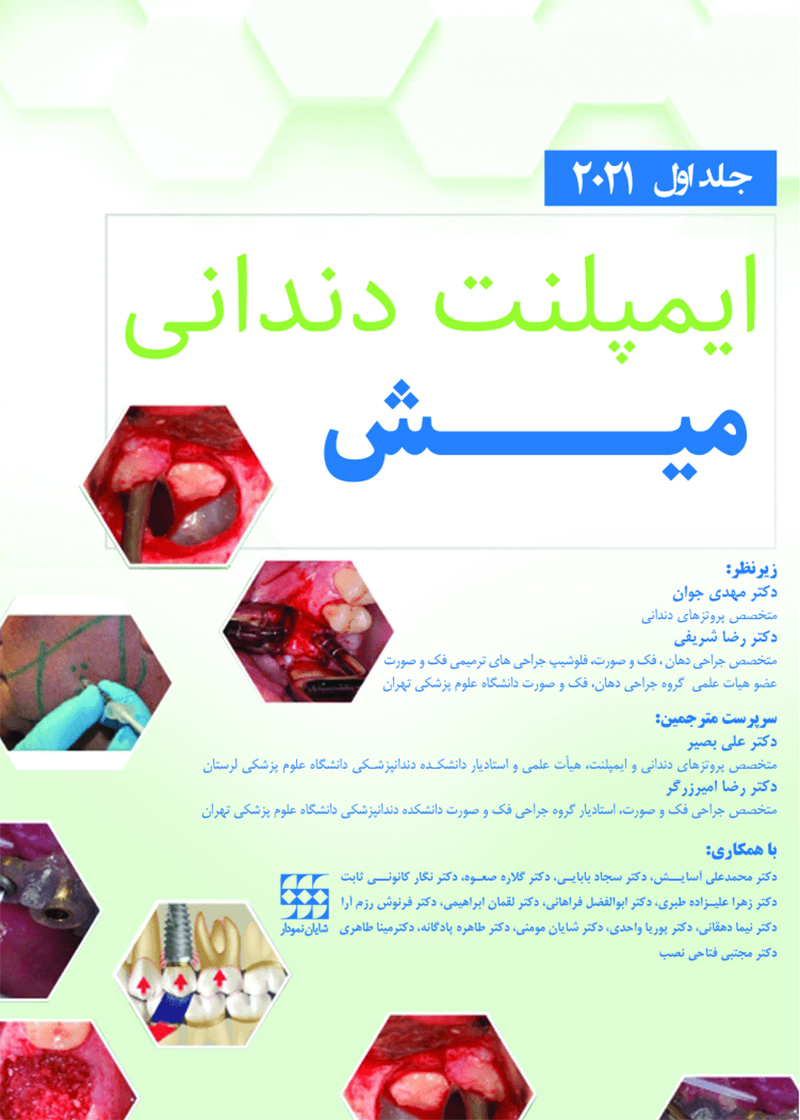 کتاب ایمپلنت دندانی میش 2021 جلد اول دکتر علی بصیر و همکاران