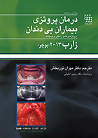 کتاب درمان پروتزی بیماران بی دندان پروتزهای کامل و متکی بر ایمپلنت زارب 2013 (بوچر)