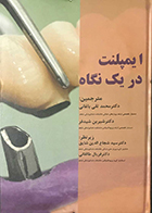 کتاب ایمپلنت در یک نگاه محمد تقی باغانی