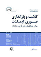 کتاب کاشت و بارگذاری فوری ایمپلنت برای جایگزینی یک یا چند دندان فاطمه شیروانی